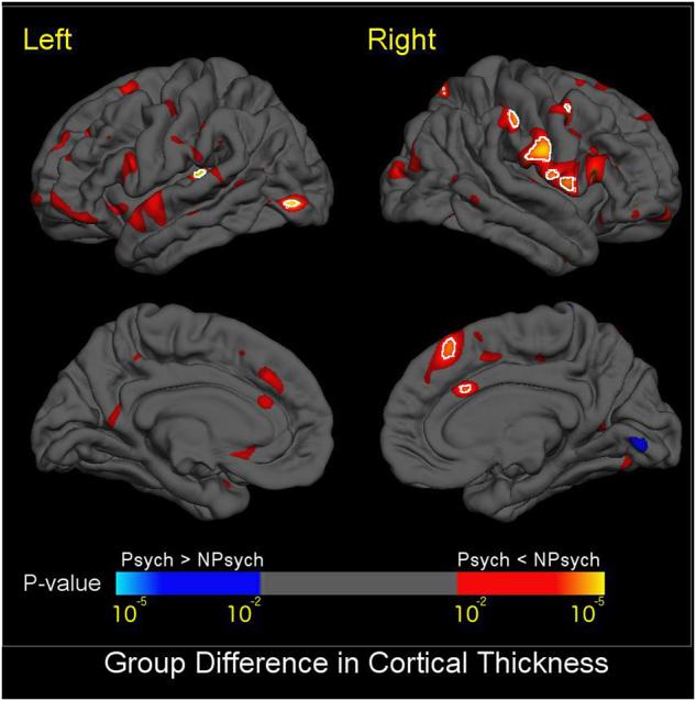 https://cdn.ncbi.nlm.nih.gov/pmc/blobs/d001/7387305/e21a4b73cb8b/41380_2018_78_Fig2_HTML.jpg
