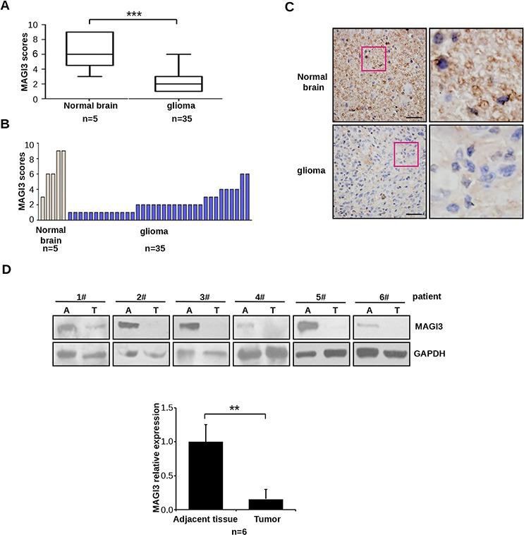 https://cdn.ncbi.nlm.nih.gov/pmc/blobs/d003/4742146/059991a648da/oncotarget-06-35851-g001.jpg