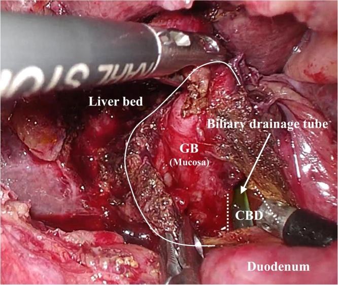 https://cdn.ncbi.nlm.nih.gov/pmc/blobs/d004/7710499/2881b4dff38d/gr3.jpg