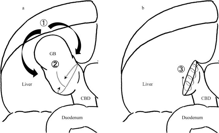 https://cdn.ncbi.nlm.nih.gov/pmc/blobs/d004/7710499/a0421f96f782/gr5.jpg
