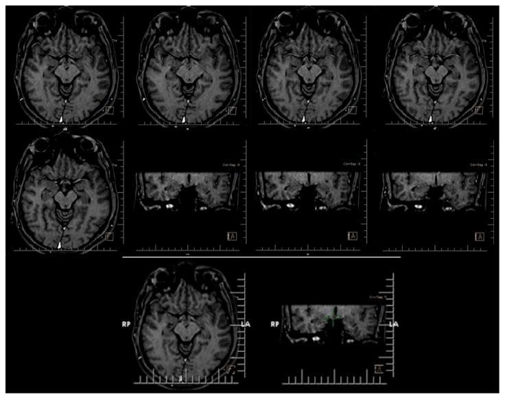 https://cdn.ncbi.nlm.nih.gov/pmc/blobs/d006/5299200/83a6992742fc/CRIM2017-2432315.003.jpg