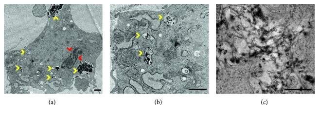 https://cdn.ncbi.nlm.nih.gov/pmc/blobs/d009/6594287/cee837cb5c68/CMMI2019-2183051.002.jpg