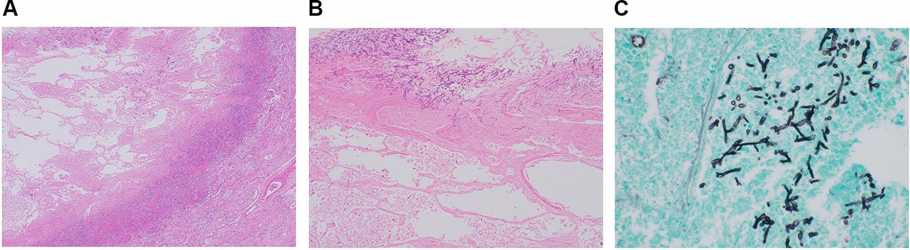 https://cdn.ncbi.nlm.nih.gov/pmc/blobs/d00b/11438172/479bf726129f/13256_2024_4793_Fig4_HTML.jpg