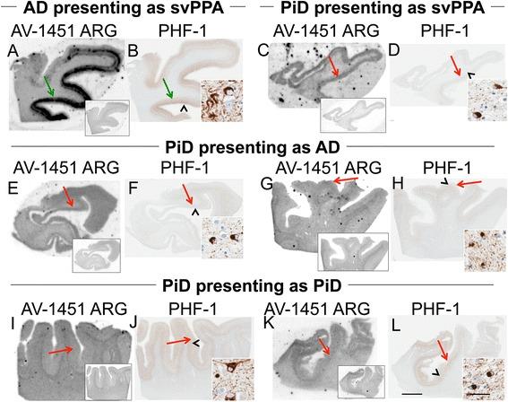 https://cdn.ncbi.nlm.nih.gov/pmc/blobs/d00b/4906968/2b2e7fc1353f/40478_2016_315_Fig4_HTML.jpg