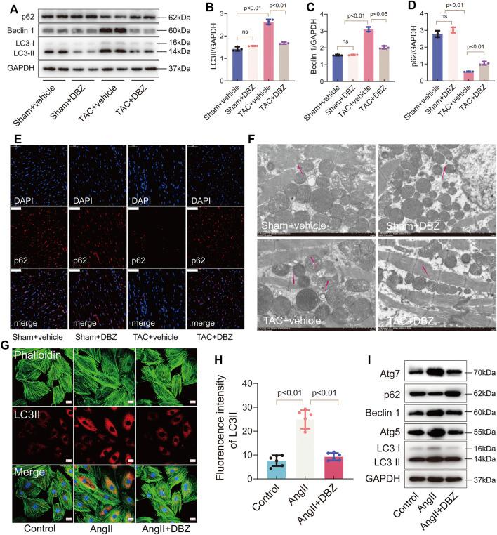 https://cdn.ncbi.nlm.nih.gov/pmc/blobs/d00f/8850779/2a1169dc1a2f/fphar-13-830763-g005.jpg
