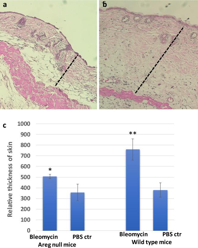 https://cdn.ncbi.nlm.nih.gov/pmc/blobs/d010/7903615/109eba5b2caa/13578_2021_553_Fig2_HTML.jpg