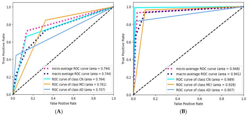 https://cdn.ncbi.nlm.nih.gov/pmc/blobs/d014/11765009/7e2fb040e86b/diagnostics-15-00211-g011a.jpg