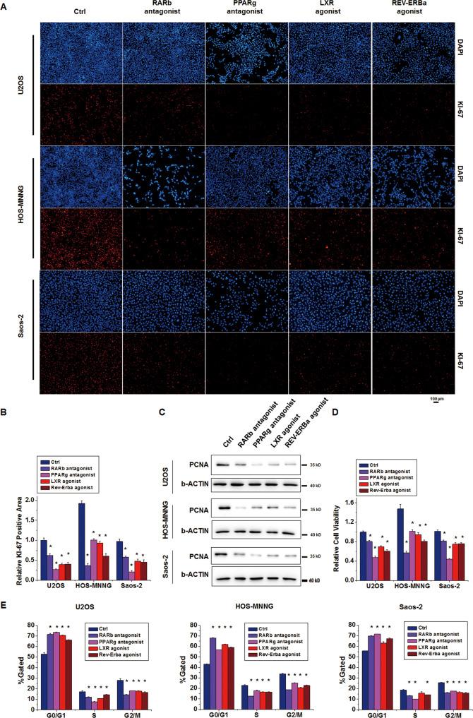https://cdn.ncbi.nlm.nih.gov/pmc/blobs/d017/9867777/865a3ea7287c/41419_2022_5545_Fig3_HTML.jpg