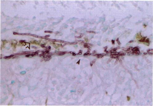 https://cdn.ncbi.nlm.nih.gov/pmc/blobs/d019/1298225/9cde654d65db/taos00001-0194-b.jpg