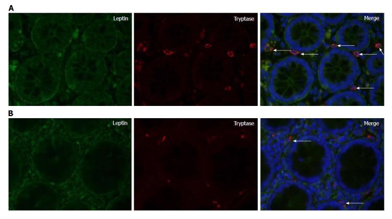 https://cdn.ncbi.nlm.nih.gov/pmc/blobs/d01e/5757124/04d017d18ad2/WJG-24-46-g003.jpg