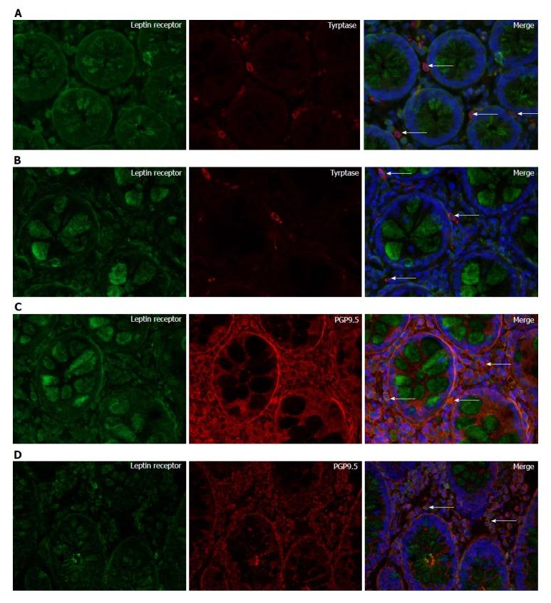 https://cdn.ncbi.nlm.nih.gov/pmc/blobs/d01e/5757124/73baeaf29d84/WJG-24-46-g004.jpg