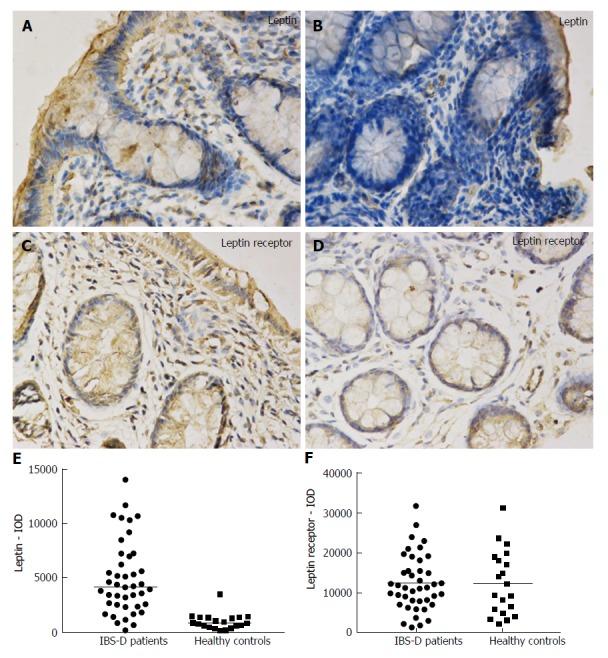 https://cdn.ncbi.nlm.nih.gov/pmc/blobs/d01e/5757124/ab936293d0bb/WJG-24-46-g002.jpg