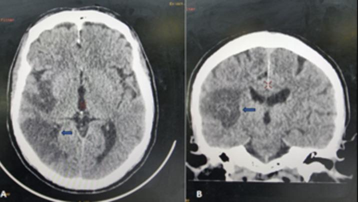 https://cdn.ncbi.nlm.nih.gov/pmc/blobs/d020/12143308/598deb98e6c5/PAMJ-50-67-g002.jpg