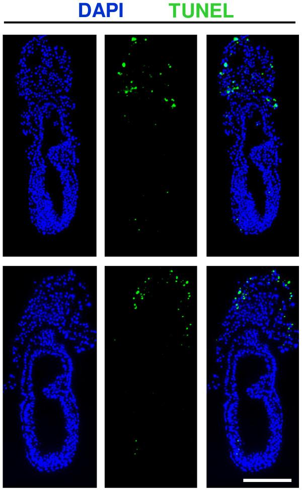 https://cdn.ncbi.nlm.nih.gov/pmc/blobs/d023/3163621/f1cb5aa97fd8/1471-213X-11-48-4.jpg