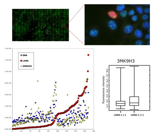 https://cdn.ncbi.nlm.nih.gov/pmc/blobs/d026/1857702/6c869d763424/1476-4598-6-28-4.jpg