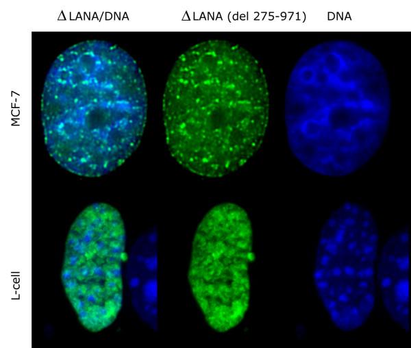 https://cdn.ncbi.nlm.nih.gov/pmc/blobs/d026/1857702/9a5bbbc1069d/1476-4598-6-28-13.jpg