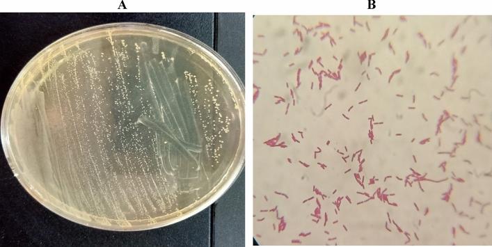 https://cdn.ncbi.nlm.nih.gov/pmc/blobs/d02a/12181349/a4ae0fae98cf/41598_2025_6103_Fig1_HTML.jpg