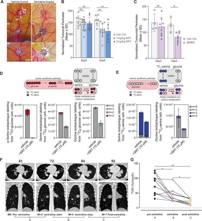 https://cdn.ncbi.nlm.nih.gov/pmc/blobs/d02c/11982353/ea74e5a89088/44321_2025_212_Fig3_HTML.jpg