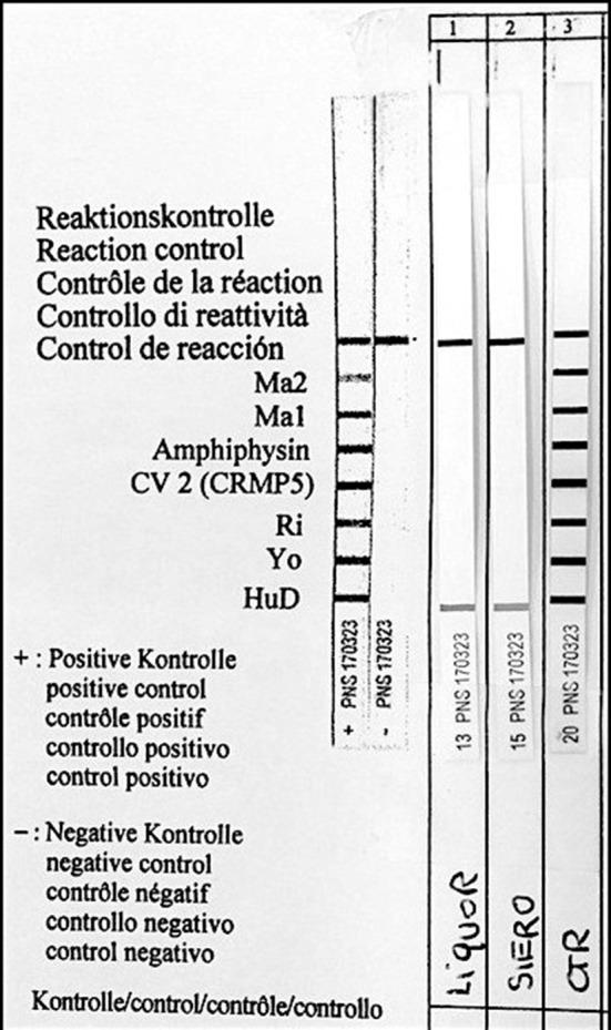 https://cdn.ncbi.nlm.nih.gov/pmc/blobs/d02f/5787932/a002b1424397/fnins-12-00017-g0002.jpg