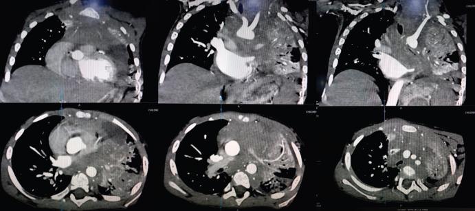 https://cdn.ncbi.nlm.nih.gov/pmc/blobs/d03c/9666274/8cd5b6f65a17/can-16-1457fig2.jpg