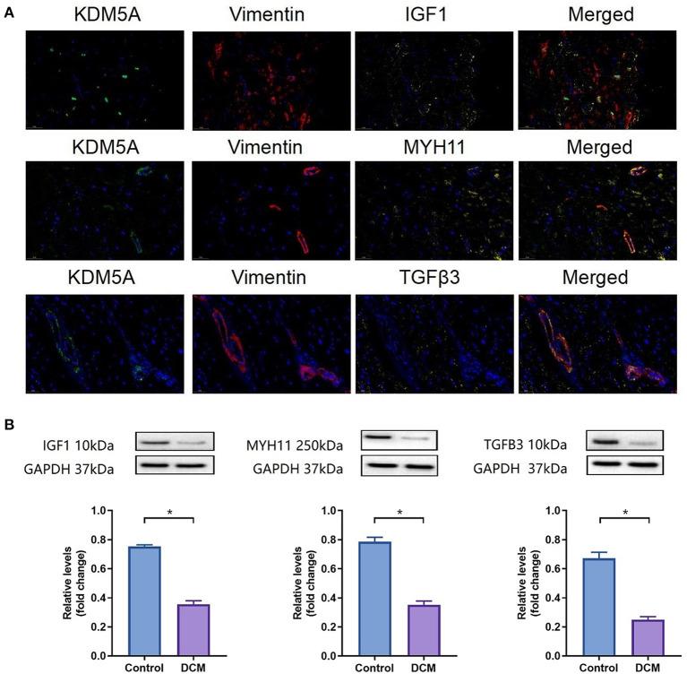 https://cdn.ncbi.nlm.nih.gov/pmc/blobs/d044/9283924/a0530ed38d48/fcvm-09-929030-g0010.jpg