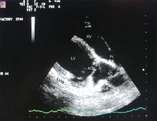 https://cdn.ncbi.nlm.nih.gov/pmc/blobs/d04b/5301175/022c05092641/VetWorld-10-22-g001.jpg