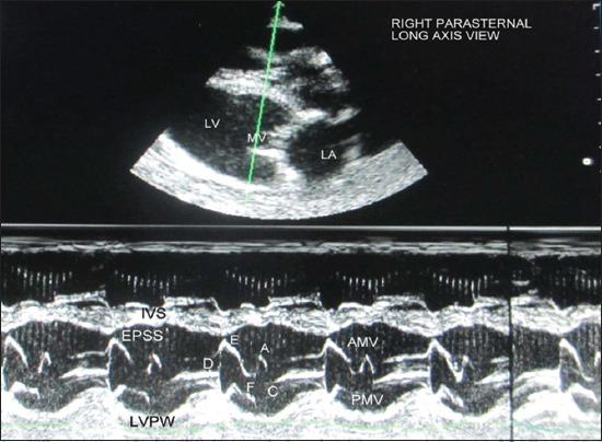https://cdn.ncbi.nlm.nih.gov/pmc/blobs/d04b/5301175/c1a9298f37c2/VetWorld-10-22-g003.jpg