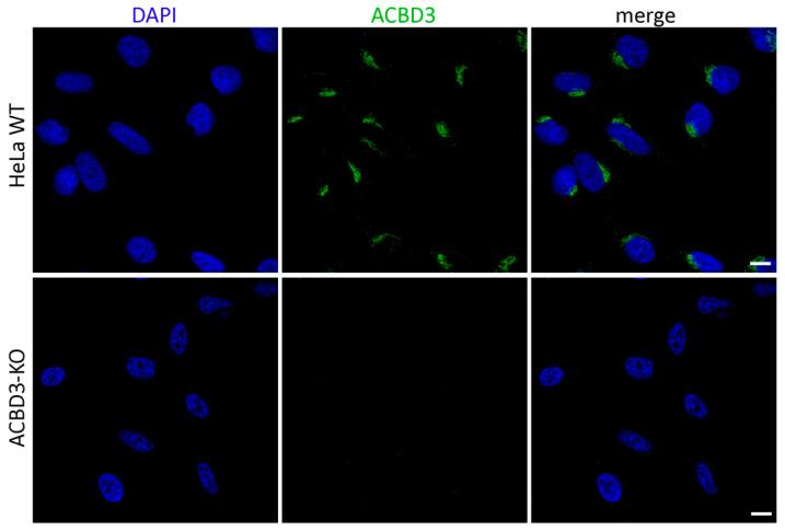 https://cdn.ncbi.nlm.nih.gov/pmc/blobs/d04c/8303370/c0bb97279e9c/ijms-22-07270-g0A1.jpg