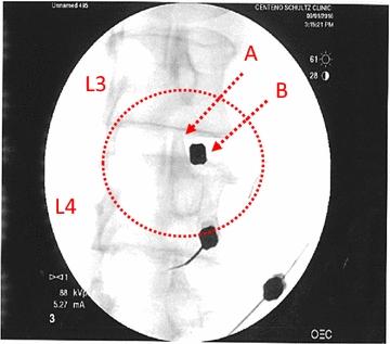 https://cdn.ncbi.nlm.nih.gov/pmc/blobs/d050/5610473/1497b4bcca8c/12967_2017_1300_Fig1_HTML.jpg