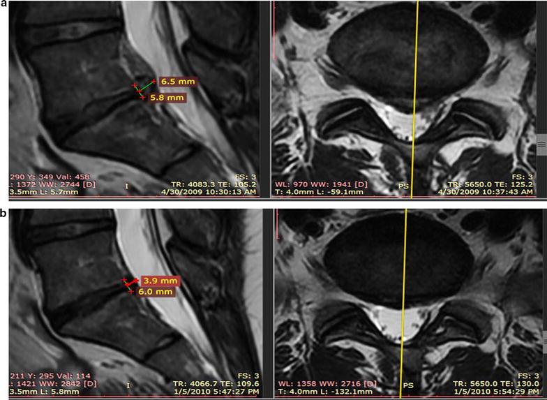 https://cdn.ncbi.nlm.nih.gov/pmc/blobs/d050/5610473/5b02134b6e71/12967_2017_1300_Fig5_HTML.jpg