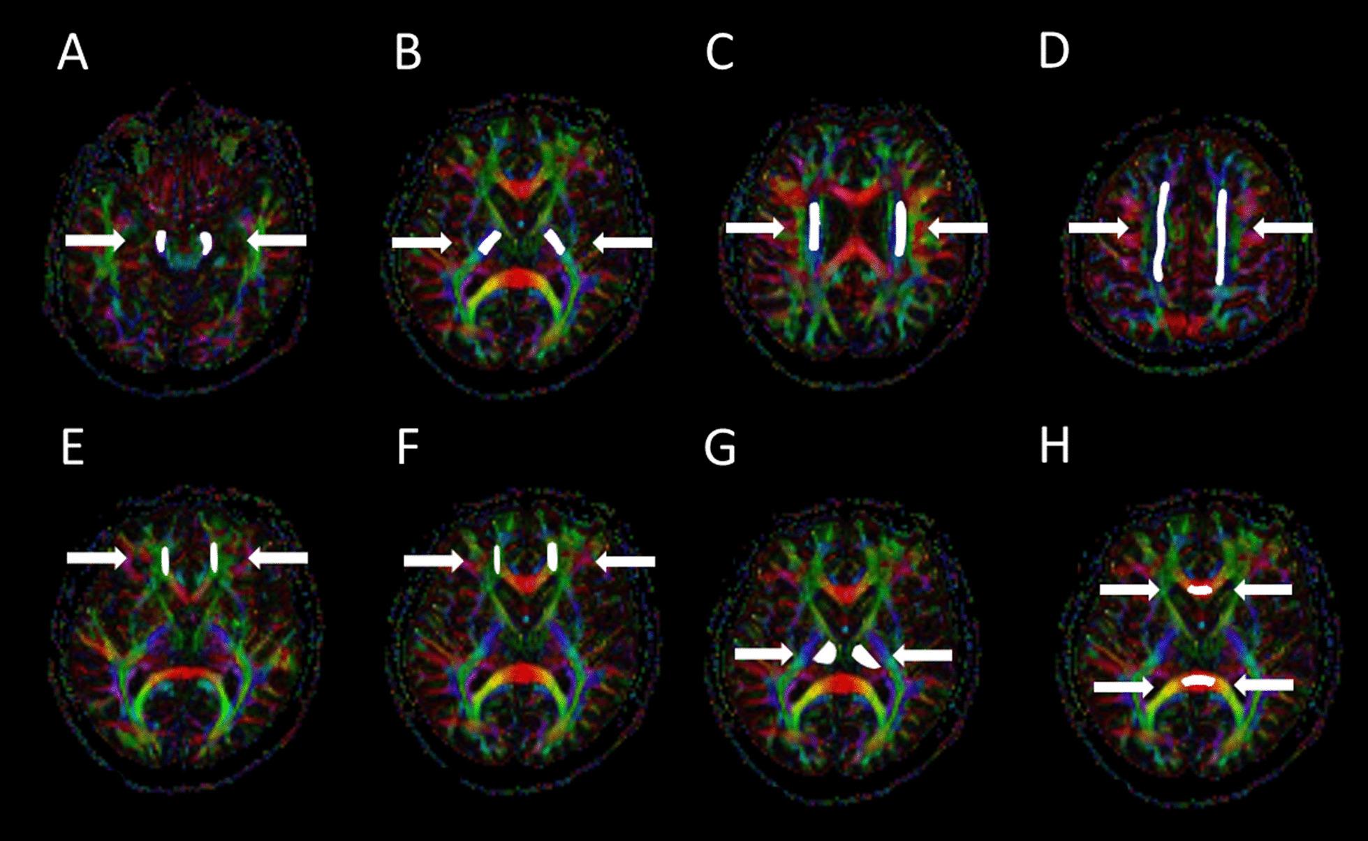 https://cdn.ncbi.nlm.nih.gov/pmc/blobs/d050/8491381/8ae8fc5ecb37/12880_2021_663_Fig3_HTML.jpg