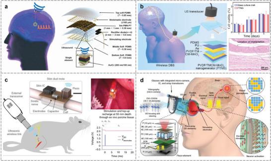 https://cdn.ncbi.nlm.nih.gov/pmc/blobs/d05b/11809411/0b7aa62c0347/ADVS-12-2408653-g014.jpg