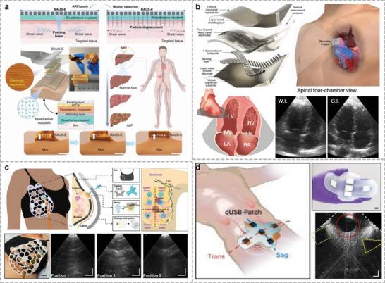 https://cdn.ncbi.nlm.nih.gov/pmc/blobs/d05b/11809411/8be75d4ba4c5/ADVS-12-2408653-g026.jpg