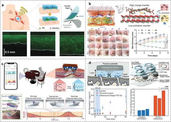 https://cdn.ncbi.nlm.nih.gov/pmc/blobs/d05b/11809411/c1d41c3dc949/ADVS-12-2408653-g007.jpg