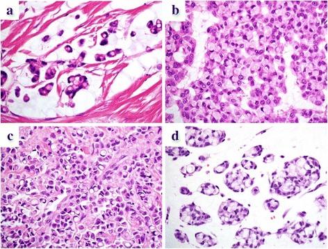 https://cdn.ncbi.nlm.nih.gov/pmc/blobs/d062/5111291/0ab119bec536/13000_2016_584_Fig1_HTML.jpg