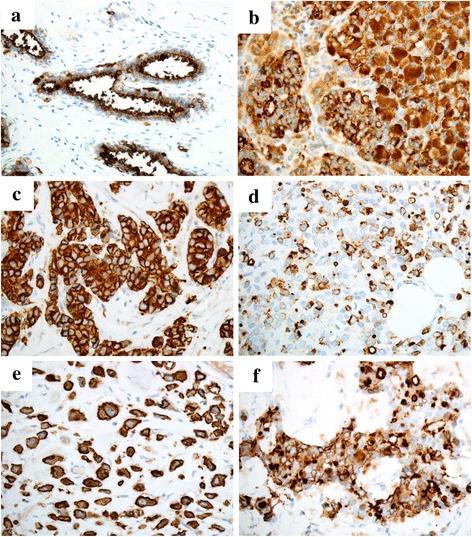 https://cdn.ncbi.nlm.nih.gov/pmc/blobs/d062/5111291/765133f48eca/13000_2016_584_Fig2_HTML.jpg