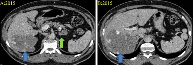 https://cdn.ncbi.nlm.nih.gov/pmc/blobs/d073/10924379/31560c72e877/12890_2024_2943_Fig1_HTML.jpg