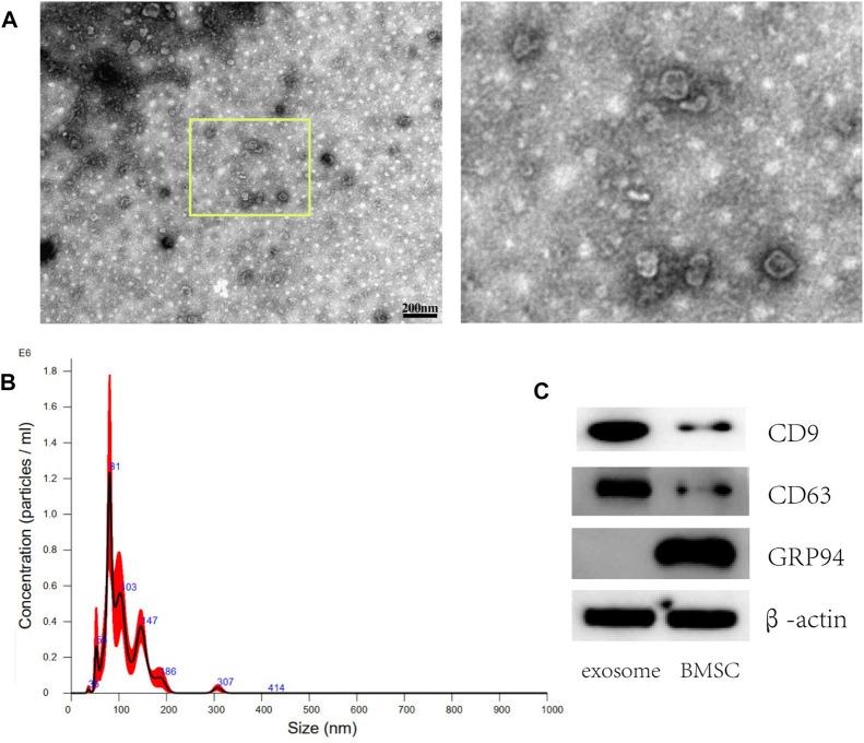 https://cdn.ncbi.nlm.nih.gov/pmc/blobs/d07b/10367419/eb4e2a35c0a5/fbioe-11-1198545-g002.jpg