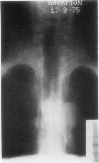 https://cdn.ncbi.nlm.nih.gov/pmc/blobs/d07d/459257/3122fcb67bc2/thorax00194-0018-a.jpg