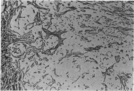 https://cdn.ncbi.nlm.nih.gov/pmc/blobs/d07d/459257/ed7a27c456f2/thorax00194-0021-b.jpg