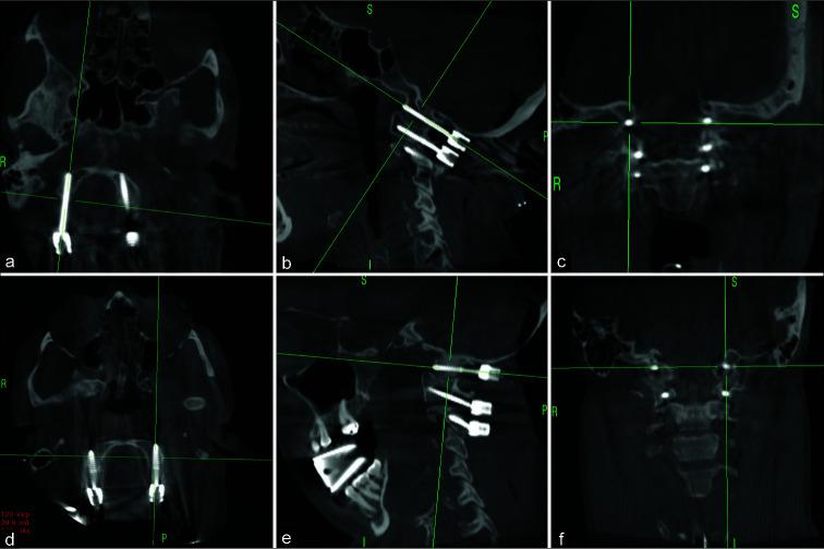 https://cdn.ncbi.nlm.nih.gov/pmc/blobs/d080/8645510/0a6bc5196fad/SNI-12-543-g002.jpg