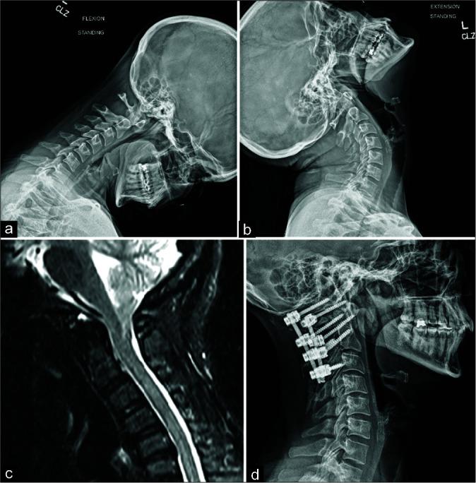 https://cdn.ncbi.nlm.nih.gov/pmc/blobs/d080/8645510/ad83be0adab4/SNI-12-543-g004.jpg
