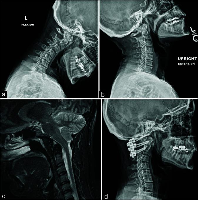 https://cdn.ncbi.nlm.nih.gov/pmc/blobs/d080/8645510/d7a9ef021a00/SNI-12-543-g003.jpg