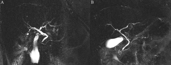 https://cdn.ncbi.nlm.nih.gov/pmc/blobs/d082/8752728/54ea728b8f8f/41598_2021_4609_Fig2_HTML.jpg