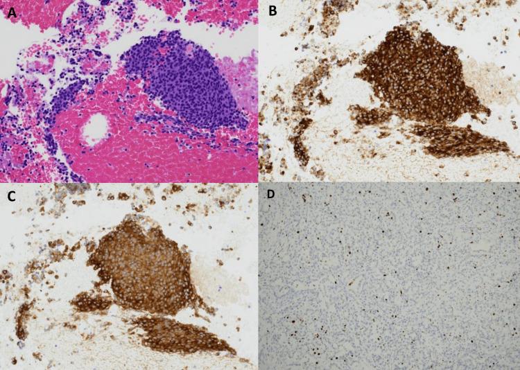 https://cdn.ncbi.nlm.nih.gov/pmc/blobs/d086/10499054/f0fe9427e2fd/cureus-0015-00000043469-i03.jpg