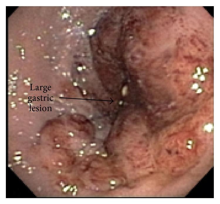 https://cdn.ncbi.nlm.nih.gov/pmc/blobs/d086/4438139/b62e38ae9e3f/CRIGM2015-438973.001.jpg