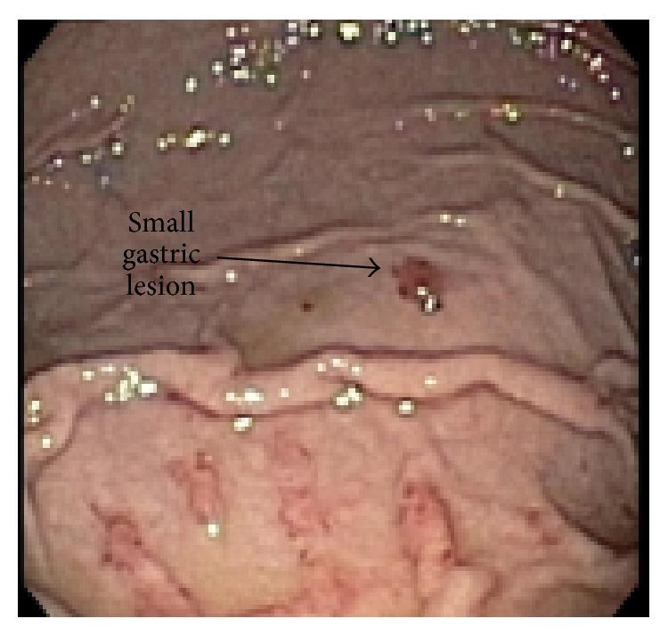 https://cdn.ncbi.nlm.nih.gov/pmc/blobs/d086/4438139/f7b2342bd2aa/CRIGM2015-438973.002.jpg