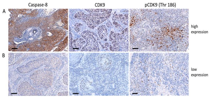 https://cdn.ncbi.nlm.nih.gov/pmc/blobs/d089/9688434/3aa96b25da8b/cancers-14-05500-g001.jpg