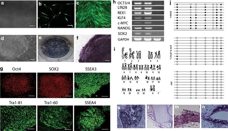 https://cdn.ncbi.nlm.nih.gov/pmc/blobs/d093/3944269/c4d71042e256/cddis201455f1.jpg