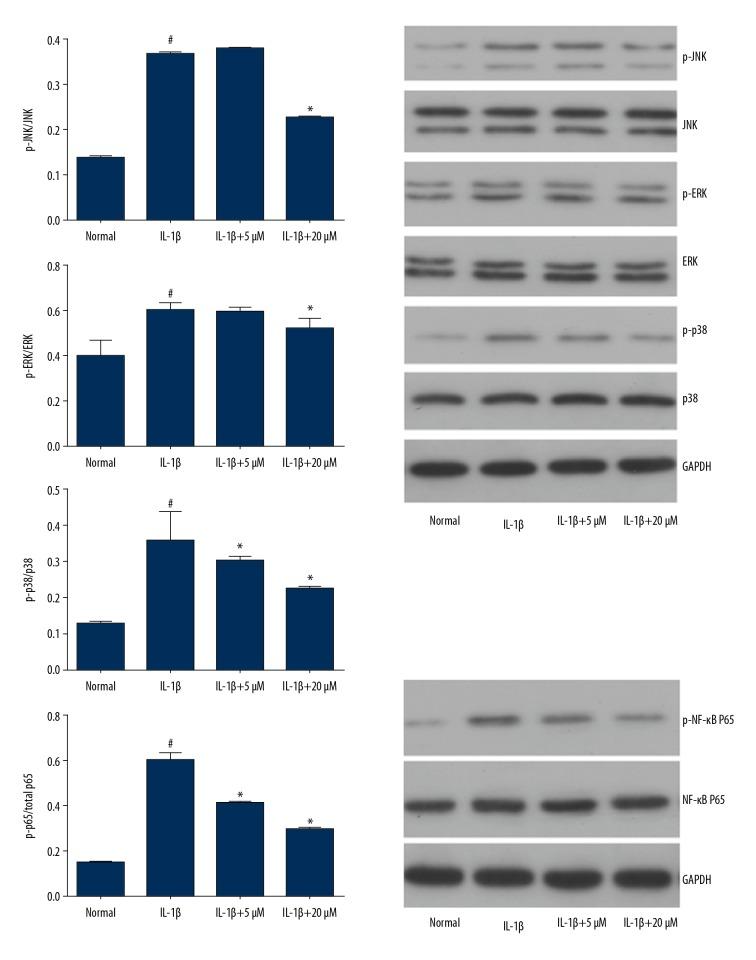 https://cdn.ncbi.nlm.nih.gov/pmc/blobs/d09d/6714594/16a9e9039f8c/medscimonit-25-6271-g007.jpg